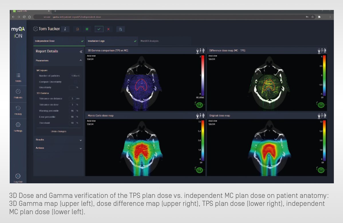 IBA Dosimetry  myQA iON Proton Therapy screen overview
